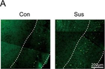 Rabbit IgG (H+L) Highly Cross-Adsorbed Secondary Antibody in Immunocytochemistry (ICC/IF)