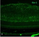 Rabbit IgG (H+L) Highly Cross-Adsorbed Secondary Antibody in Immunohistochemistry (IHC)
