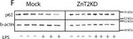 Mouse IgG (H+L) Secondary Antibody in Western Blot (WB)