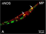 Rabbit IgG (H+L) Cross-Adsorbed Secondary Antibody in Immunocytochemistry (ICC/IF)