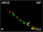 Rabbit IgG (H+L) Cross-Adsorbed Secondary Antibody in Immunocytochemistry (ICC/IF)