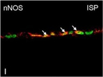 Rabbit IgG (H+L) Cross-Adsorbed Secondary Antibody in Immunocytochemistry (ICC/IF)