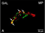 Rabbit IgG (H+L) Cross-Adsorbed Secondary Antibody in Immunocytochemistry (ICC/IF)