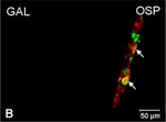 Rabbit IgG (H+L) Cross-Adsorbed Secondary Antibody in Immunocytochemistry (ICC/IF)