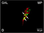 Rabbit IgG (H+L) Cross-Adsorbed Secondary Antibody in Immunocytochemistry (ICC/IF)