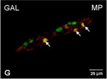 Rabbit IgG (H+L) Cross-Adsorbed Secondary Antibody in Immunocytochemistry (ICC/IF)