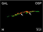 Rabbit IgG (H+L) Cross-Adsorbed Secondary Antibody in Immunocytochemistry (ICC/IF)