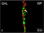 Rabbit IgG (H+L) Cross-Adsorbed Secondary Antibody in Immunocytochemistry (ICC/IF)