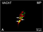 Rabbit IgG (H+L) Cross-Adsorbed Secondary Antibody in Immunocytochemistry (ICC/IF)