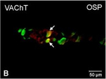 Rabbit IgG (H+L) Cross-Adsorbed Secondary Antibody in Immunocytochemistry (ICC/IF)