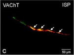 Rabbit IgG (H+L) Cross-Adsorbed Secondary Antibody in Immunocytochemistry (ICC/IF)