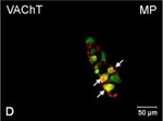 Rabbit IgG (H+L) Cross-Adsorbed Secondary Antibody in Immunocytochemistry (ICC/IF)