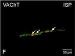 Rabbit IgG (H+L) Cross-Adsorbed Secondary Antibody in Immunocytochemistry (ICC/IF)