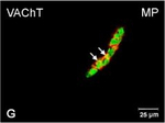 Rabbit IgG (H+L) Cross-Adsorbed Secondary Antibody in Immunocytochemistry (ICC/IF)