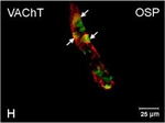 Rabbit IgG (H+L) Cross-Adsorbed Secondary Antibody in Immunocytochemistry (ICC/IF)
