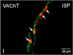 Rabbit IgG (H+L) Cross-Adsorbed Secondary Antibody in Immunocytochemistry (ICC/IF)