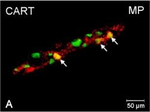 Rabbit IgG (H+L) Cross-Adsorbed Secondary Antibody in Immunocytochemistry (ICC/IF)