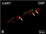 Rabbit IgG (H+L) Cross-Adsorbed Secondary Antibody in Immunocytochemistry (ICC/IF)