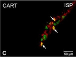 Rabbit IgG (H+L) Cross-Adsorbed Secondary Antibody in Immunocytochemistry (ICC/IF)