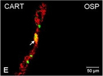 Rabbit IgG (H+L) Cross-Adsorbed Secondary Antibody in Immunocytochemistry (ICC/IF)