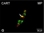 Rabbit IgG (H+L) Cross-Adsorbed Secondary Antibody in Immunocytochemistry (ICC/IF)