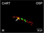 Rabbit IgG (H+L) Cross-Adsorbed Secondary Antibody in Immunocytochemistry (ICC/IF)