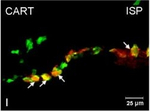 Rabbit IgG (H+L) Cross-Adsorbed Secondary Antibody in Immunocytochemistry (ICC/IF)