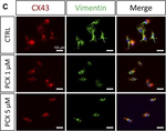 Mouse IgG (H+L) Cross-Adsorbed Secondary Antibody in Immunocytochemistry (ICC/IF)