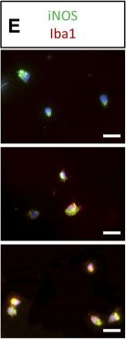 Goat IgG (H+L) Cross-Adsorbed Secondary Antibody in Immunocytochemistry (ICC/IF)
