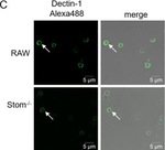Goat IgG (H+L) Cross-Adsorbed Secondary Antibody in Immunocytochemistry (ICC/IF)