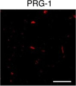 Rabbit IgG (H+L) Cross-Adsorbed Secondary Antibody in Immunocytochemistry (ICC/IF)