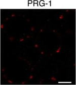 Rabbit IgG (H+L) Cross-Adsorbed Secondary Antibody in Immunocytochemistry (ICC/IF)
