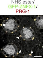Rabbit IgG (H+L) Cross-Adsorbed Secondary Antibody in Immunocytochemistry (ICC/IF)