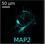 Mouse IgG (H+L) Cross-Adsorbed Secondary Antibody in Immunocytochemistry (ICC/IF)