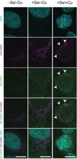 Mouse IgG (H+L) Highly Cross-Adsorbed Secondary Antibody in Immunocytochemistry (ICC/IF)