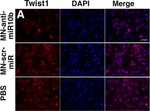 Mouse IgG1 Cross-Adsorbed Secondary Antibody in Immunocytochemistry (ICC/IF)
