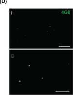 Mouse IgG (H+L) Highly Cross-Adsorbed Secondary Antibody in Immunocytochemistry (ICC/IF)