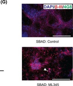 Mouse IgG (H+L) Highly Cross-Adsorbed Secondary Antibody in Immunocytochemistry (ICC/IF)
