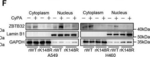 Rabbit IgG (H+L) Secondary Antibody in Western Blot (WB)