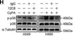 Rabbit IgG (H+L) Secondary Antibody in Western Blot (WB)