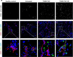 Rat IgG (H+L) Cross-Adsorbed Secondary Antibody in Immunohistochemistry (Frozen) (IHC (F))