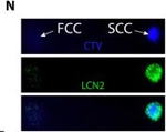 Goat IgG (H+L) Cross-Adsorbed Secondary Antibody in Immunocytochemistry (ICC/IF)