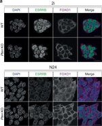 Rabbit IgG (H+L) Highly Cross-Adsorbed Secondary Antibody in Immunocytochemistry (ICC/IF)