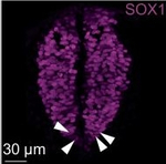 Goat IgG (H+L) Cross-Adsorbed Secondary Antibody in Immunocytochemistry (ICC/IF)