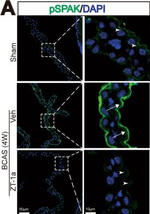 Rabbit IgG (H+L) Cross-Adsorbed Secondary Antibody in Immunocytochemistry (ICC/IF)