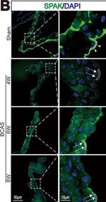 Rabbit IgG (H+L) Cross-Adsorbed Secondary Antibody in Immunocytochemistry (ICC/IF)