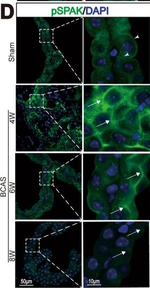 Rabbit IgG (H+L) Cross-Adsorbed Secondary Antibody in Immunocytochemistry (ICC/IF)