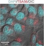 Rabbit IgG (H+L) Cross-Adsorbed Secondary Antibody in Immunocytochemistry (ICC/IF)