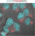 Rabbit IgG (H+L) Cross-Adsorbed Secondary Antibody in Immunocytochemistry (ICC/IF)