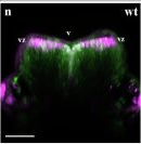 Rabbit IgG (H+L) Cross-Adsorbed Secondary Antibody in Immunohistochemistry (PFA fixed) (IHC (PFA))